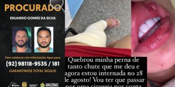 Procurado por ajudar a desovar corpo de babá já foi acusado de quebrar a perna da ex em Manaus